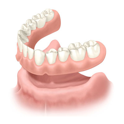 рисунок зубного протеза